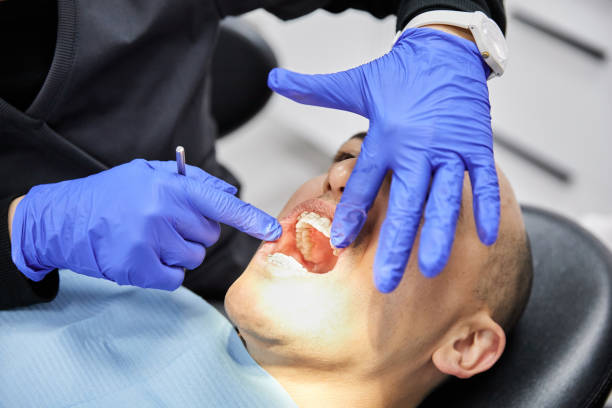 Best Emergency Broken Tooth Repair in San Bruno, CA